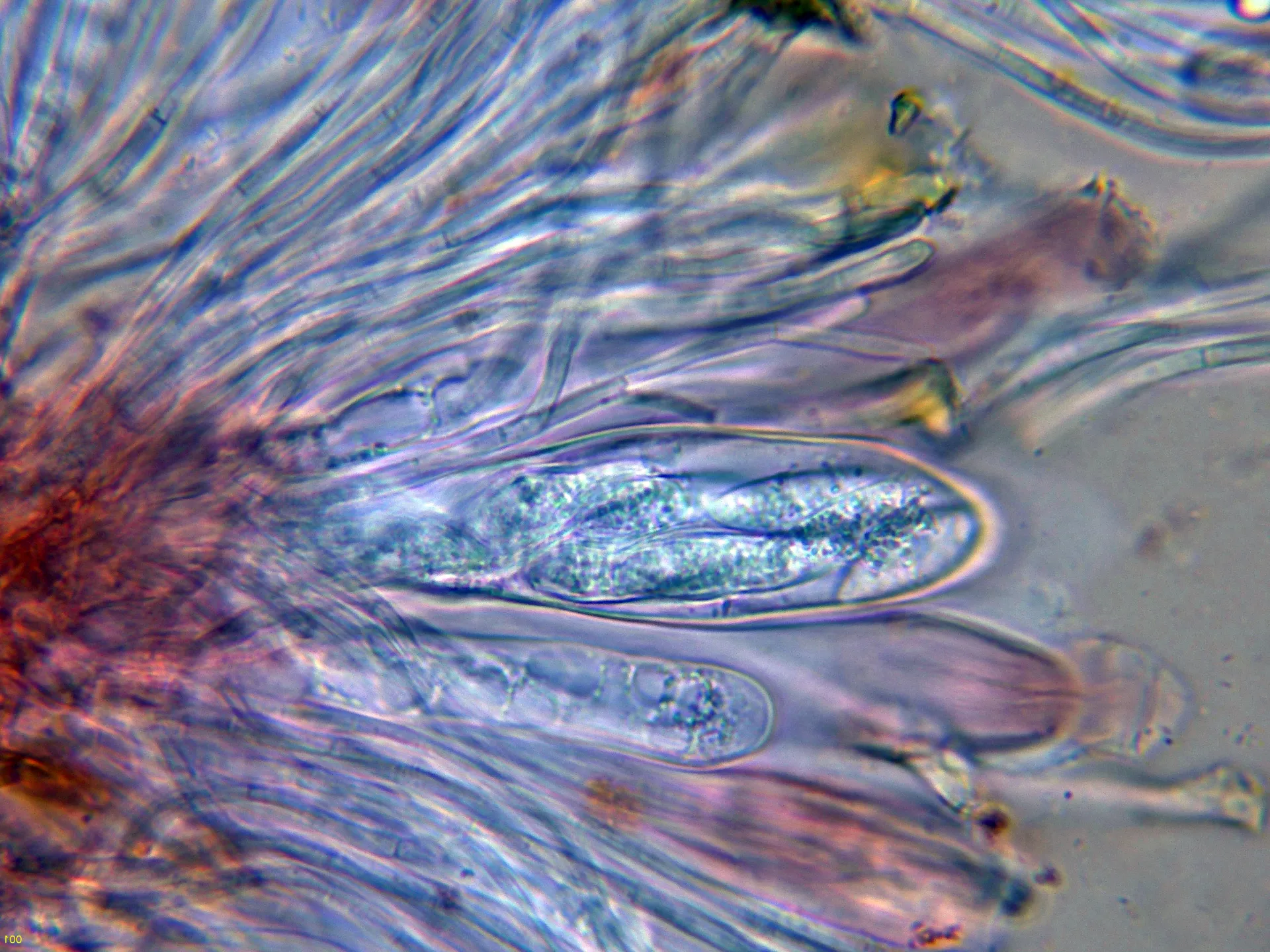 Microscopía de Lobaria pulmonaria - 10 - Asco-001